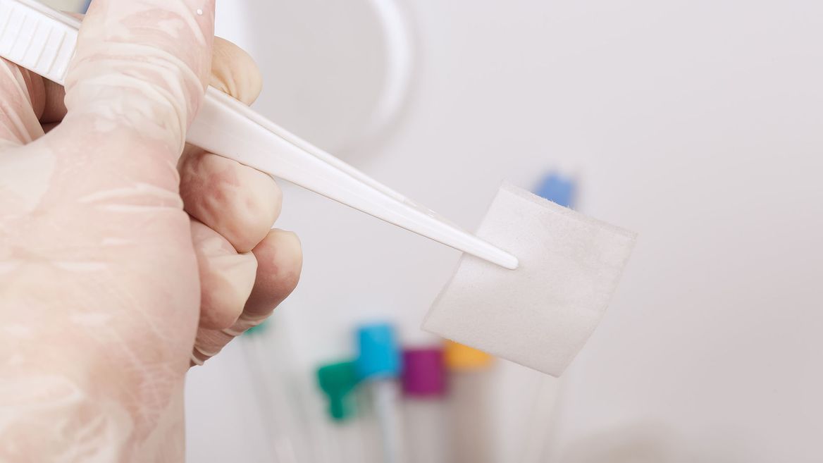 Эффективное применение спиртовых салфеток Эффективное применение спиртовых салфеток